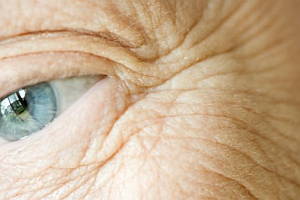 wrinkles-eye